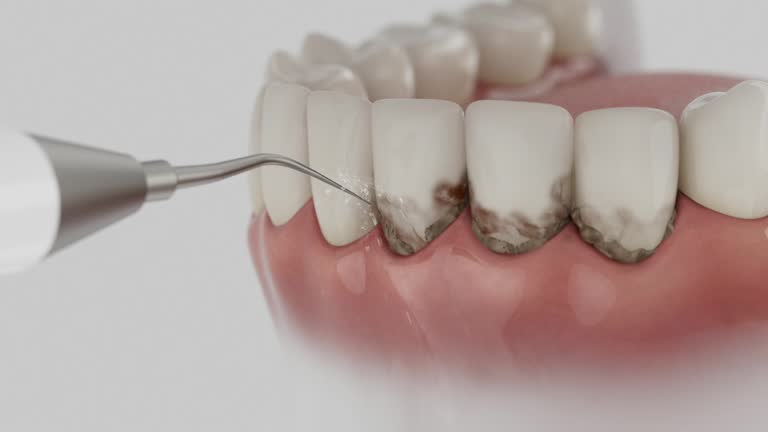 Reliable Dental Implants contractor in Lake Magdalene, FL by Smile Center Dentistry